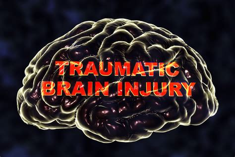 What Is Chronic Traumatic Encephalopathy Cte Premiere Research