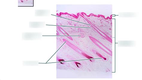 Dermis Diagram | Quizlet