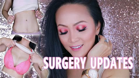 Life Vlog Breast Augmentation Tummy Tuck Surgery 1 Year Update Arrem