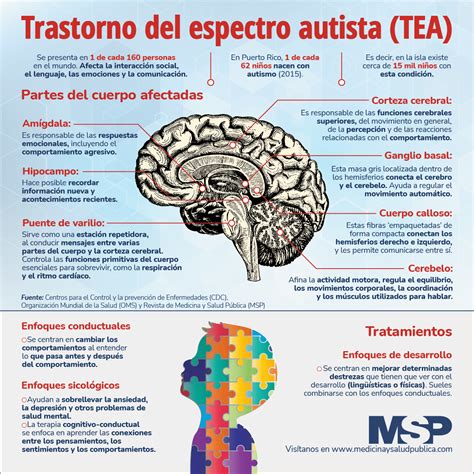 Caso Clinico Tea C Caso Clinico Trastorno Del Espectro Autista Sexiz Pix