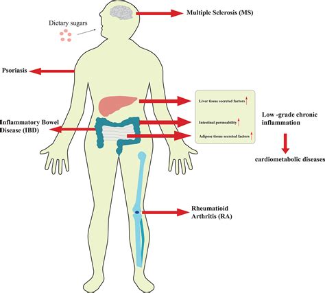 Frontiers Excessive Intake Of Sugar An Accomplice Of Inflammation