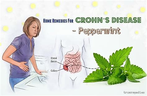 20 Natural Home Remedies For Crohns Disease Symptom Relief