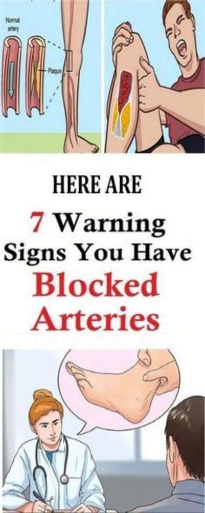 Here Are 7 Warning Signs You Have Blocked Arteries LIFESTYLE