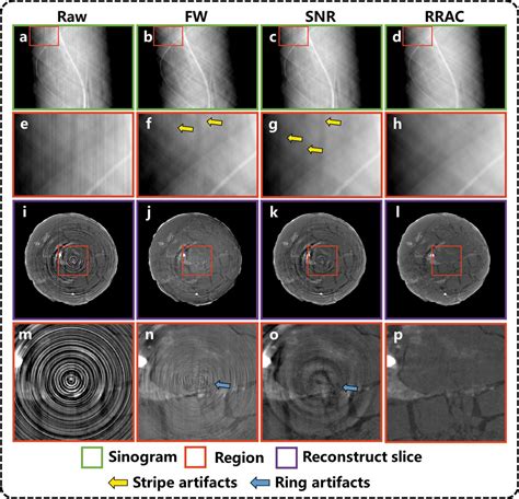 Iucr Deep Learning Based Ring Artifact Correction For Tomographic Reconstruction