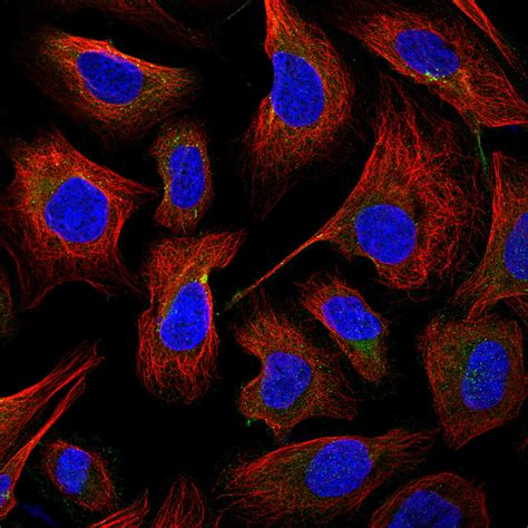 Subcellular Arpc The Human Protein Atlas