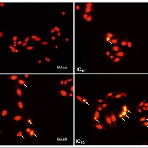 Cell Morphology Of FEE Treated MDA MB 231 Apoptotic Cells After 24 H