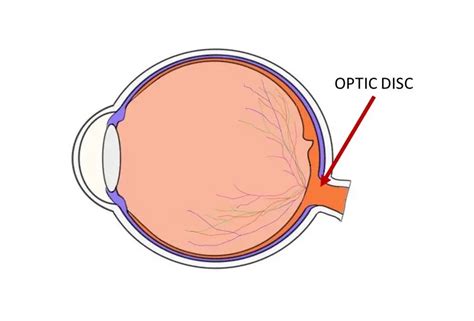 Optic disc - definition