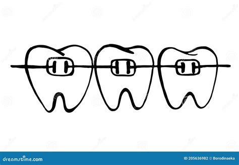 Three Teeth With Braces Stock Vector Illustration Of Facial 205636982