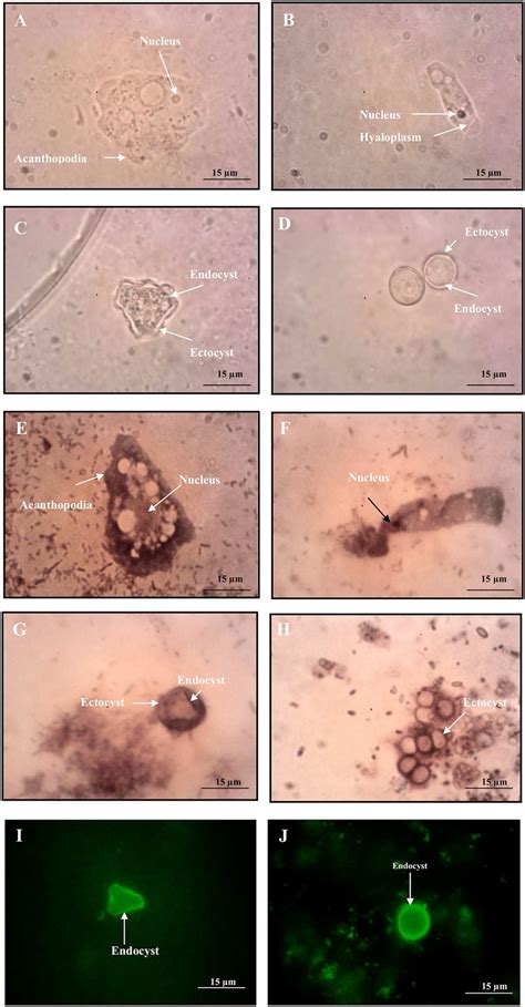 Acanthamoeba Cyst Morphology