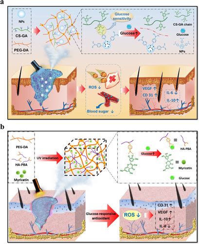 Hydrogel Wound Dressings For Diabetic Foot Ulcer Treatment Status‐quo Challenges And Future