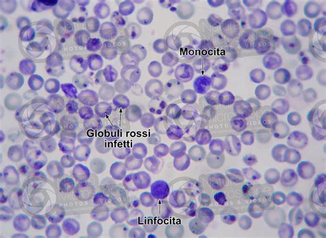 Plasmodium Berghei Malaria 500x Protozoa Protozoi Endoparassiti Parassitologia Foto