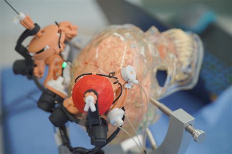 Hku Engineering Team Enhances Stereotactic Neurosurgery Precision Using