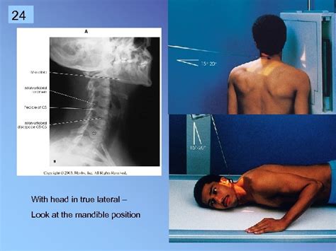 1 Cervical Spine Rtec 124 Week 6 Rev