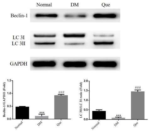 Beclin 1 And Lc 3 Protein Expression By Wb Assay Normal The Normal