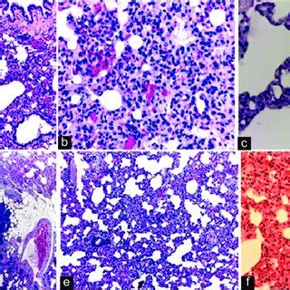 A Lung Of Rat With Abscesses Inflammatory Cells Infiltration And