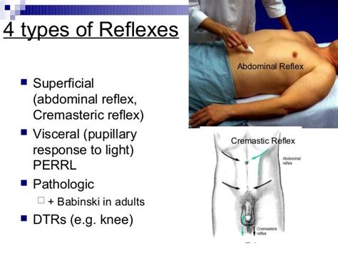 Neurological Assessment Sp07 Webversion