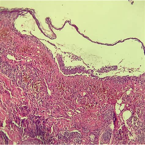 Histopathological Examination Stained With Hematoxylin And Eosin Showing