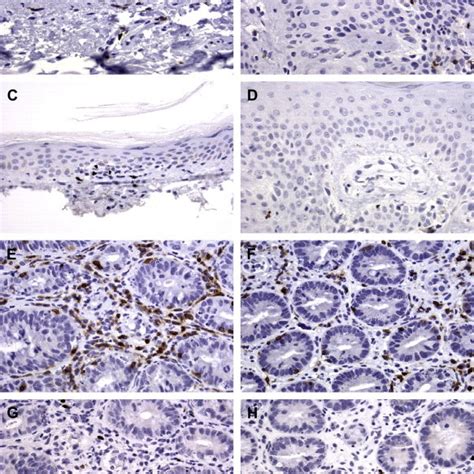 Photomicrographs Of Immunostains For Cd A B E And F And Foxp C