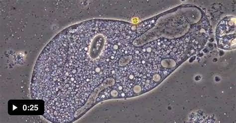 Microscope Footage Of Soap Dissolving The Membrane Of A Ciliate 9gag