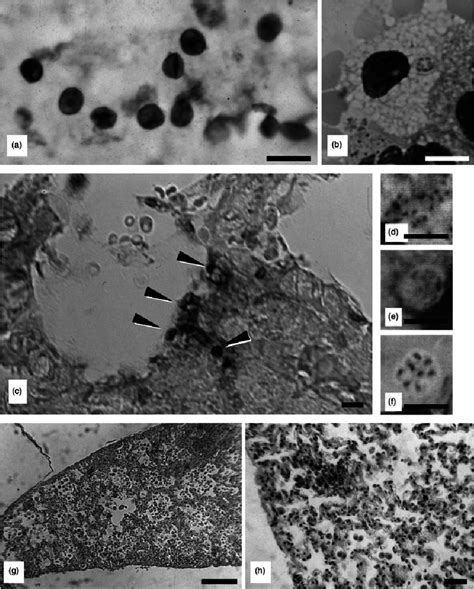 Pneumocystis Oryctolagi Spnov Morphology And Pathology At The Light Download Scientific