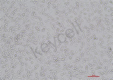 大鼠肾上腺嗜铬细胞瘤细胞 Pc 12高分化（种属鉴定正确）细胞系细胞库旗赛生物科技（武汉）有限公司