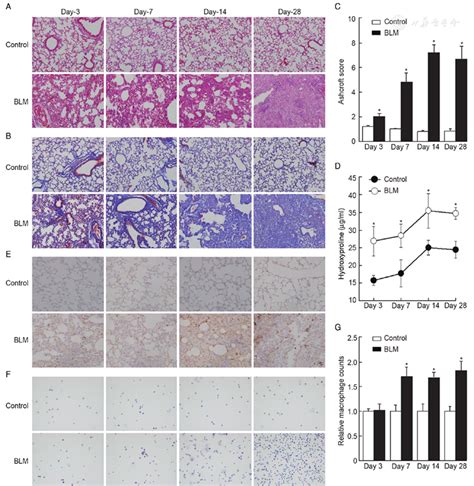 Macrophage Exosomes Transfer Angiotensin Ii Type Receptor To Lung