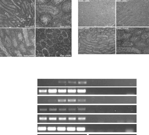 In Situ Hybridization Of Ssm Rara Rarb And Rarg A In Situ