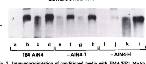 Figure From Stimulation Of Epithelial Membrane Antigen Expression By