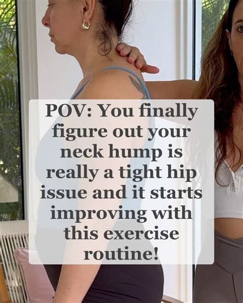 Lauren Ohayon Core Pelvic Floor On Instagram Neck Hump Although The Problem Shows Up At