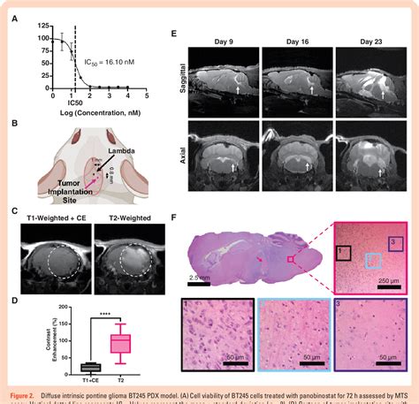 Pdf Mri Guided Focused Ultrasound Bloodbrain Barrier Opening