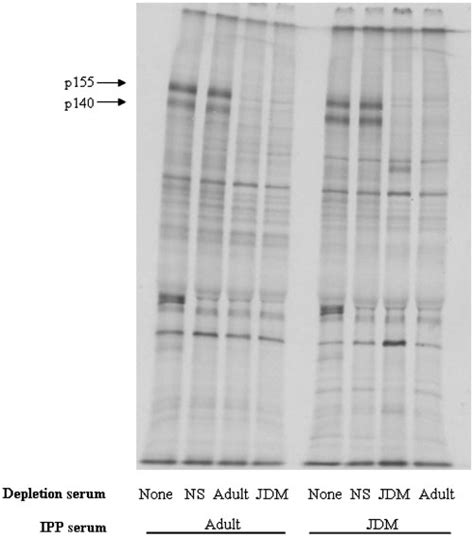 Immunodepletion Experimentsautoradiogram Of Sdspage Of