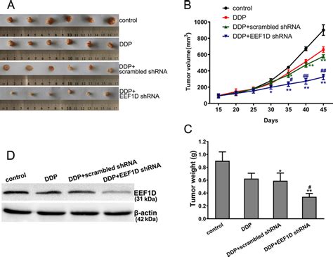 Reducing The Expression Of EEF1D Gene Significantly Strengthened DDP