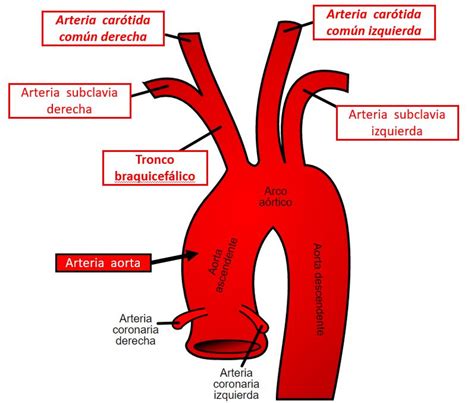 Arteria Car Tida Interna Dolopedia