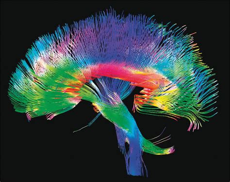 🔥 The major neuronal pathways of the human brain : r/NatureIsFuckingLit