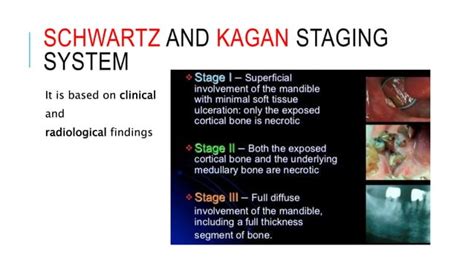 Osteoradionecrosis Of The Jaws The Modern Management PPT