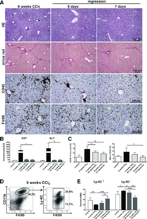 Dynamic Changes Of Intrahepatic Macrophage Subsets During Regression