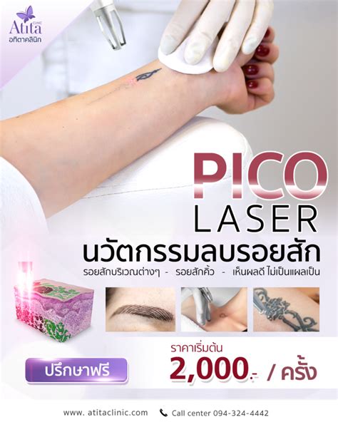 PICO LASER คออะไร ราคาเทาไหร ชวยแกปญหาผวอะไรไดบาง