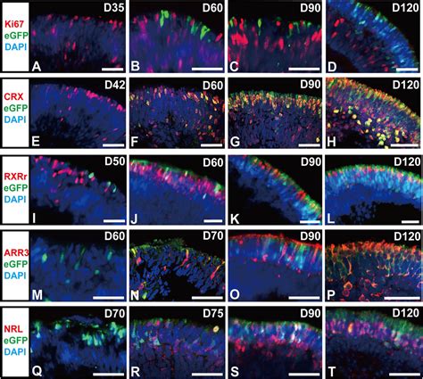 Frontiers Generation Of An Rcvrn Egfp Reporter Hipsc Line By Crispr