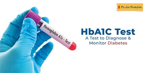 What Is The Hba C Test Dr Lal Pathlabs Blogs