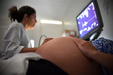 Sociedade Civil Se Prepara Para Enfrentar O Zika V Rus No Ver O