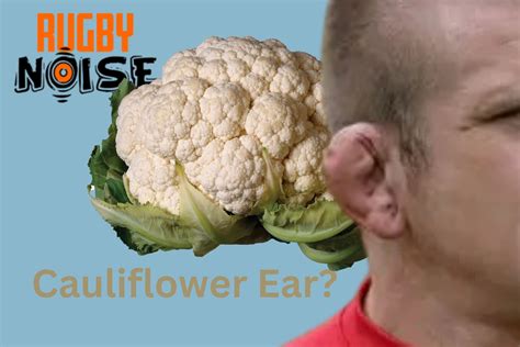 Why do rugby players get Cauliflower ears? – Rugby Noise