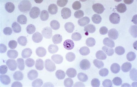 Free picture: micrograph, mature, plasmodium vivax, trophozoite 