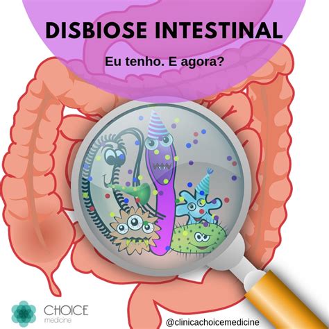 Como Tratar A Disbiose - Choice Medicine: Disbiose intestinal: Eu tenho, e agora?