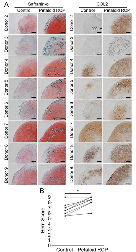 Histological Appearance Of The Cartilage Pellet Derived From Synovial