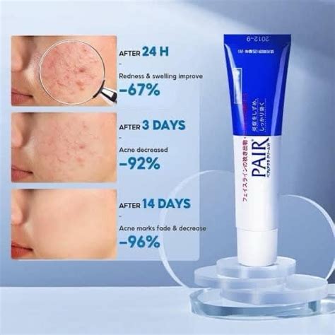 Lion Pair Acne Cream W 18gm Dr Lilii Beauty