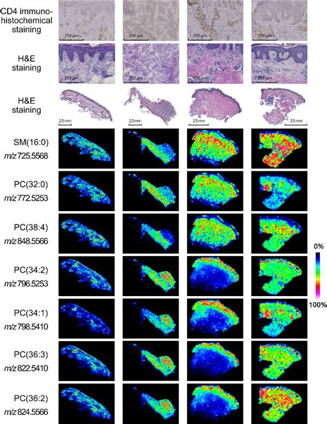 Figure 1 From Tissue And Serum Lipidome Shows Altered Lipid Composition