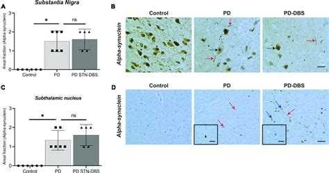 Quantitation Of Alpha Synuclein Pathology In The Substantia Nigra Sn