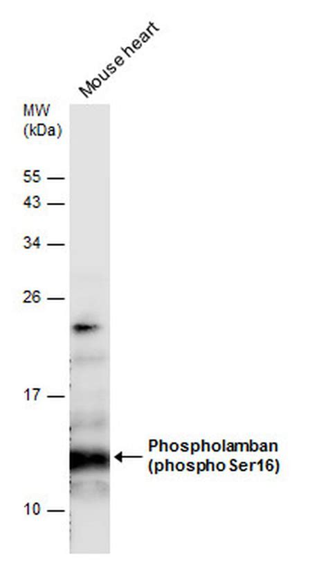 Phospho Phospholamban Ser16 Polyclonal Antibody Pa5 85740