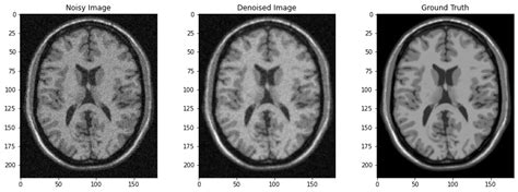 Image Denoising With Markov Random Fields Mohd Safwan