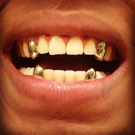 Canine Teeth With Back Bar Grillz Set Grillz Australia